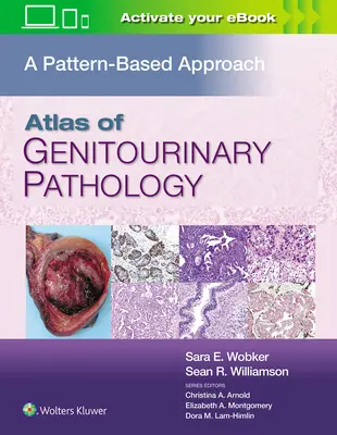 Atlas der genitourinären Pathologie: Ein musterbasierter Ansatz - Atlas of Genitourinary Pathology: A Pattern Based Approach