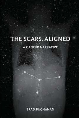 Die Narben, Ausgerichtet - The Scars, Aligned