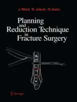 Planung und Repositionstechnik in der Frakturchirurgie - Planning and Reduction Technique in Fracture Surgery