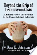 Jenseits des Griffs der Craniosynostose: Ein Einblick in das von der angeborenen Schädeldeformität betroffene Leben - Beyond the Grip of Craniosynostosis: An Inside View of Life Touched by the Congenital Skull Deformity