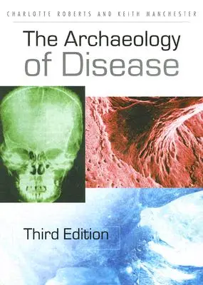 Die Archäologie der Krankheit - The Archaeology of Disease