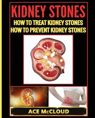 Nierensteine: Wie man Nierensteine behandelt: Wie man Nierensteinen vorbeugt - Kidney Stones: How To Treat Kidney Stones: How To Prevent Kidney Stones