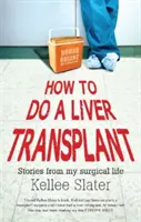 Wie man eine Lebertransplantation durchführt: Geschichten aus meinem chirurgischen Leben - How to do a liver transplant: Stories from my surgical life