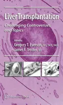 Lebertransplantation: Herausfordernde Kontroversen und Themen - Liver Transplantation: Challenging Controversies and Topics