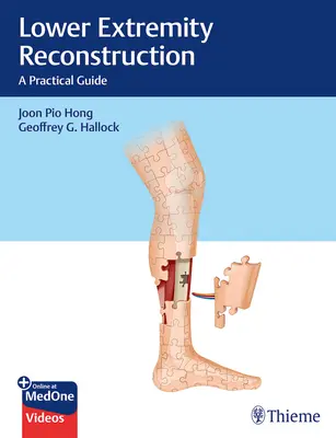Rekonstruktion der unteren Extremitäten: Ein praktischer Leitfaden - Lower Extremity Reconstruction: A Practical Guide