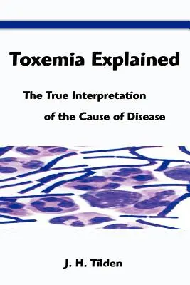 Toxemia Explained: Die wahre Interpretation der Krankheitsursache - Toxemia Explained: The True Interpretation of the Cause of Disease