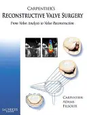 Carpentier's Rekonstruktive Klappenchirurgie: Von der Klappenanalyse zur Klappenrekonstruktion - Carpentier's Reconstructive Valve Surgery: From Valve Analysis to Valve Reconstruction