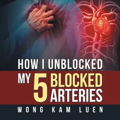 Wie ich meine 5 verstopften Arterien entblockiert habe - How I Unblocked My 5 Blocked Arteries