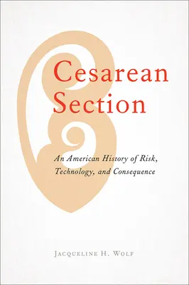 Kaiserschnitt: Eine amerikanische Geschichte von Risiko, Technologie und Konsequenz - Cesarean Section: An American History of Risk, Technology, and Consequence