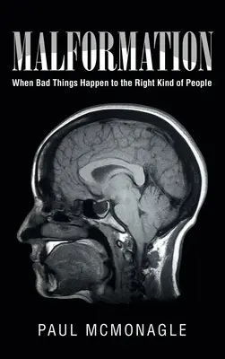 Fehlbildung: Wenn schlimme Dinge den richtigen Leuten passieren - Malformation: When Bad Things Happen to the Right Kind of People