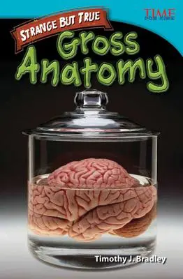 Seltsam, aber wahr: Grobe Anatomie - Strange but True: Gross Anatomy