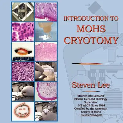 Einführung in die MOHS-Kryotomie - Introduction to MOHS Cryotomy