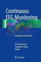 Kontinuierliche EEG-Überwachung: Grundsätze und Praxis - Continuous Eeg Monitoring: Principles and Practice