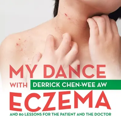 Mein Tanz mit dem Ekzem: Und 80 Lektionen für den Patienten und den Arzt - My Dance with Eczema: And 80 Lessons for the Patient and the Doctor