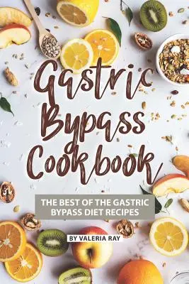 Gastric Bypass Kochbuch: Das Beste aus den Rezepten der Magenbypass-Diät - Gastric Bypass Cookbook: The Best of The Gastric Bypass Diet Recipes