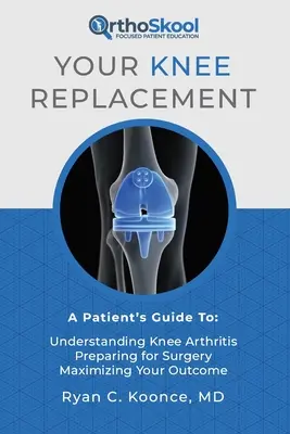 Ihr Kniegelenkersatz: Ein Leitfaden für Patienten: Kniearthrose verstehen, sich auf die Operation vorbereiten, das Ergebnis optimieren - Your Knee Replacement: A Patient's Guide To: Understanding Knee Arthritis, Preparing for Surgery, Maximizing Your Outcome