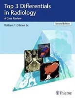 Die 3 wichtigsten Differentialdiagnosen in der Radiologie: Eine Fallbesprechung - Top 3 Differentials in Radiology: A Case Review