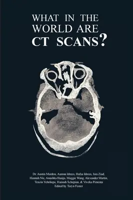 Was in aller Welt sind CT-Scans? - What in the World are CT Scans?