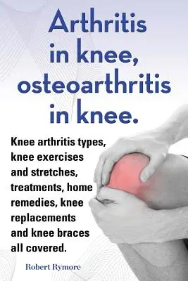 Arthritis im Knie, Osteoarthritis im Knie. Knie Arthritis Arten, Knie-Übungen und dehnt, Behandlungen, Hausmittel, Knie-Ersatz und Knie b - Arthritis in knee, osteoarthritis in knee. Knee arthritis types, knee exercises and stretches, treatments, home remedies, knee replacements and knee b