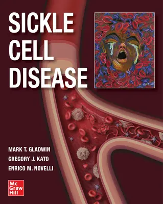 Sichelzellenkrankheit - Sickle Cell Disease