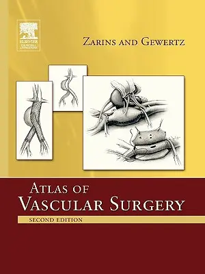 Atlas der Gefäßchirurgie - Taschenbuchausgabe - Atlas of Vascular Surgery - Paperback Edition