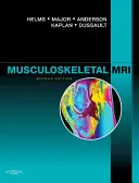 Muskuloskelettale MRT - Musculoskeletal MRI