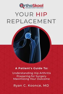 Ihr Hüftgelenkersatz: Leitfaden für Patienten: Arthrose in der Hüfte verstehen, sich auf die Operation vorbereiten, das Ergebnis optimieren - Your Hip Replacement: A Patient's Guide To: Understanding Hip Arthritis, Preparing for Surgery, Maximizing Your Outcome