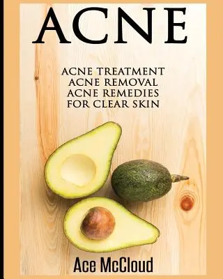 Akne: Akne-Behandlung: Akne-Entfernung: Akne-Heilmittel für klare Haut - Acne: Acne Treatment: Acne Removal: Acne Remedies For Clear Skin