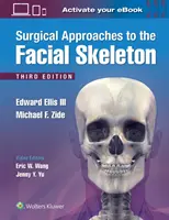 Chirurgische Eingriffe am Gesichtsskelett - Surgical Approaches to the Facial Skeleton