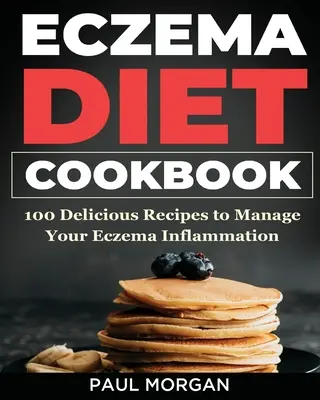 Ekzem-Diät-Kochbuch: 100 leckere Rezepte zur Behandlung von Ekzem-Entzündungen - Eczema DIet Cookbook: 100 Delicious Recipes to Manage your Eczema Inflammation