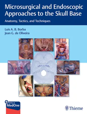 Mikrochirurgische und endoskopische Eingriffe an der Schädelbasis: Anatomie, Taktik und Techniken - Microsurgical and Endoscopic Approaches to the Skull Base: Anatomy, Tactics, and Techniques