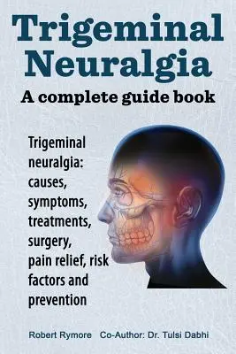 Trigeminusneuralgie: ein kompletter Leitfaden. Trigeminusneuralgie: Ursachen, Symptome, Behandlung, Operation, - Trigeminal neuralgia: a complete guide book. Trigeminal neuralgia: causes, symptoms, treatments, surgery,