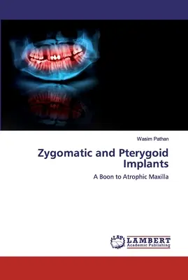 Jochbein- und Pterygoid-Implantate - Zygomatic and Pterygoid Implants