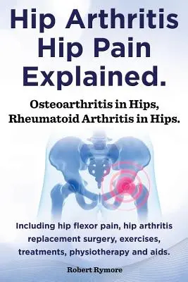 Hüftarthrose, Hüftschmerzen erklärt. Arthrose in der Hüfte, rheumatoide Arthritis in der Hüfte. Einschließlich Hüftarthrose Chirurgie, Hüftbeuger Schmerzen, Übungen, - Hip Arthritis, Hip Pain Explained. Osteoarthritis in Hips, Rheumatoid Arthritis in Hips. Including Hip Arthritis Surgery, Hip Flexor Pain, Exercises,