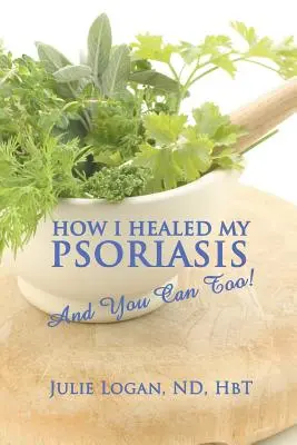 Wie ich meine Schuppenflechte geheilt habe: Und das können Sie auch! - How I Healed My Psoriasis: And You Can Too!
