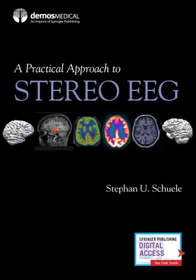 Eine praktische Annäherung an das Stereo-EEG - A Practical Approach to Stereo Eeg