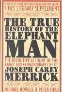 Die wahre Geschichte des Elefantenmenschen - True History of the Elephant Man