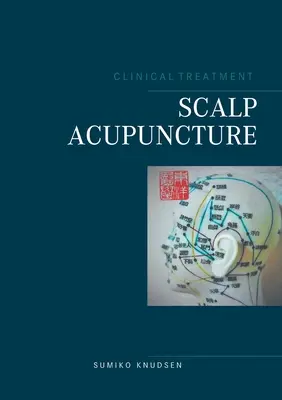 Kopfhaut-Akupunktur - Scalp Acupuncture