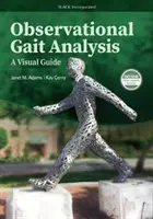 Ganganalyse durch Beobachtung: Ein visueller Leitfaden - Observational Gait Analysis: A Visual Guide