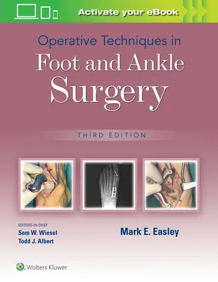 Operative Techniken in der Fuß- und Sprunggelenkschirurgie - Operative Techniques in Foot and Ankle Surgery