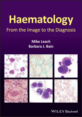 Hämatologie: Vom Bild zur Diagnose - Haematology: From the Image to the Diagnosis