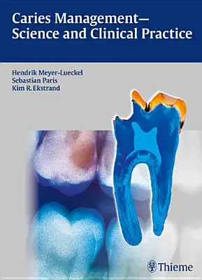 Kariesmanagement - Wissenschaft und klinische Praxis - Caries Management - Science and Clinical Practice