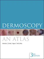 Dermoskopie: Ein Atlas - Dermoscopy: An Atlas