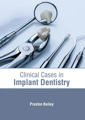 Klinische Fälle in der Implantologie - Clinical Cases in Implant Dentistry