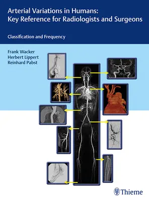 Arterielle Variationen beim Menschen: Eine wichtige Referenz für Radiologen und Chirurgen: Klassifikationen und Häufigkeit - Arterial Variations in Humans: Key Reference for Radiologists and Surgeons: Classifications and Frequency