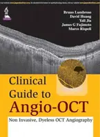 Klinischer Leitfaden für Angio-OCT: Nicht-invasive, farbstofffreie OCT-Angiographie - Clinical Guide to Angio-OCT: Non Invasive, Dyeless OCT Angiography