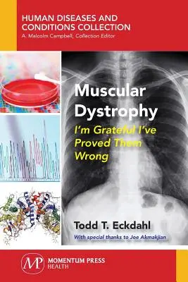 Muskeldystrophie: Ich bin dankbar, dass ich ihnen das Gegenteil bewiesen habe - Muscular Dystrophy: I'm Grateful I've Proved Them Wrong