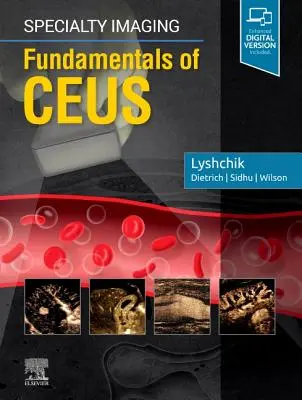 Spezialisierte Bildgebung: Grundlagen der Ceus - Specialty Imaging: Fundamentals of Ceus