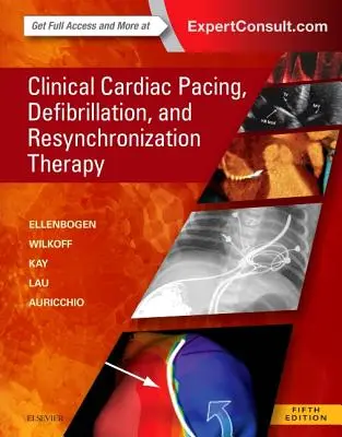 Klinische Herzschrittmacher, Defibrillation und Resynchronisationstherapie - Clinical Cardiac Pacing, Defibrillation and Resynchronization Therapy