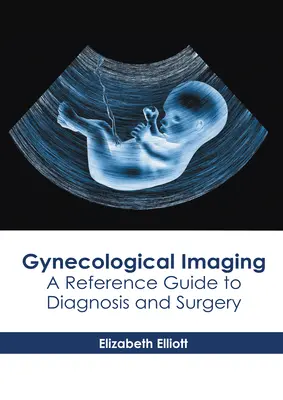 Gynäkologische Bildgebung: Ein Referenzhandbuch für Diagnose und Chirurgie - Gynecological Imaging: A Reference Guide to Diagnosis and Surgery